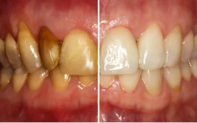 The Mouth-Body Connection: Why Healthy Teeth and Gums Are Key to Overall Wellness