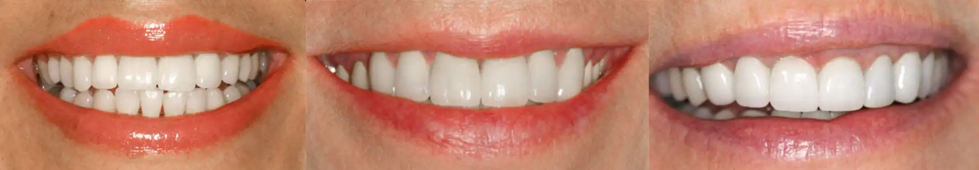 Example of 3 smiles from the gallery
