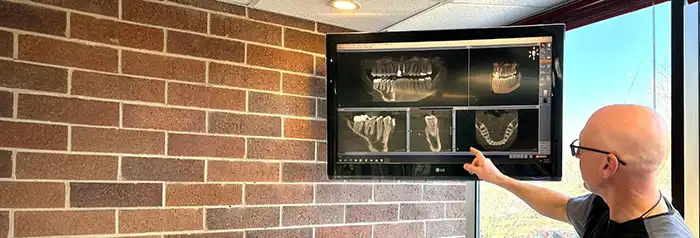 Periodontics implants Dr Feldner pointing at monitor in operating room 2d