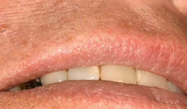Close-up of a mouth with lips parted, showing the two front teeth and a small gap between them.