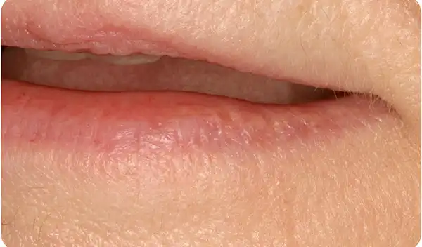 Close-up of a person's lips with dry, slightly chapped skin.
